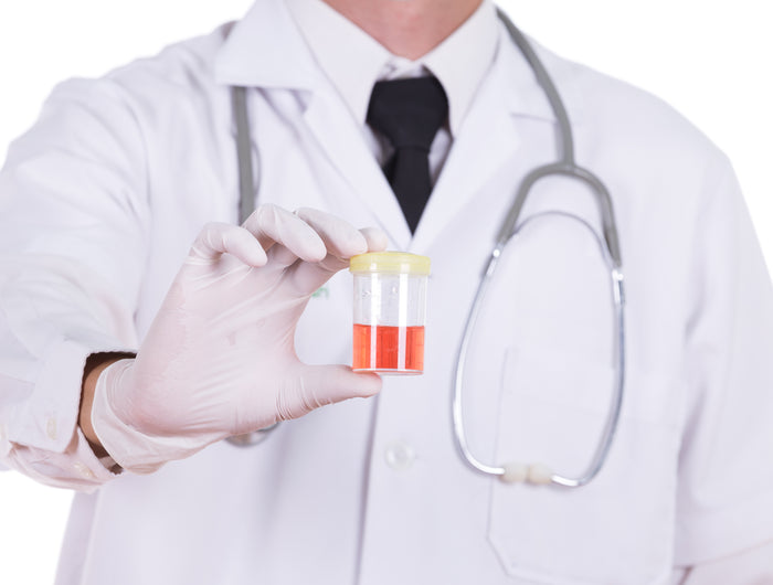 Blut im Urin - Ratgeber – A+M Care